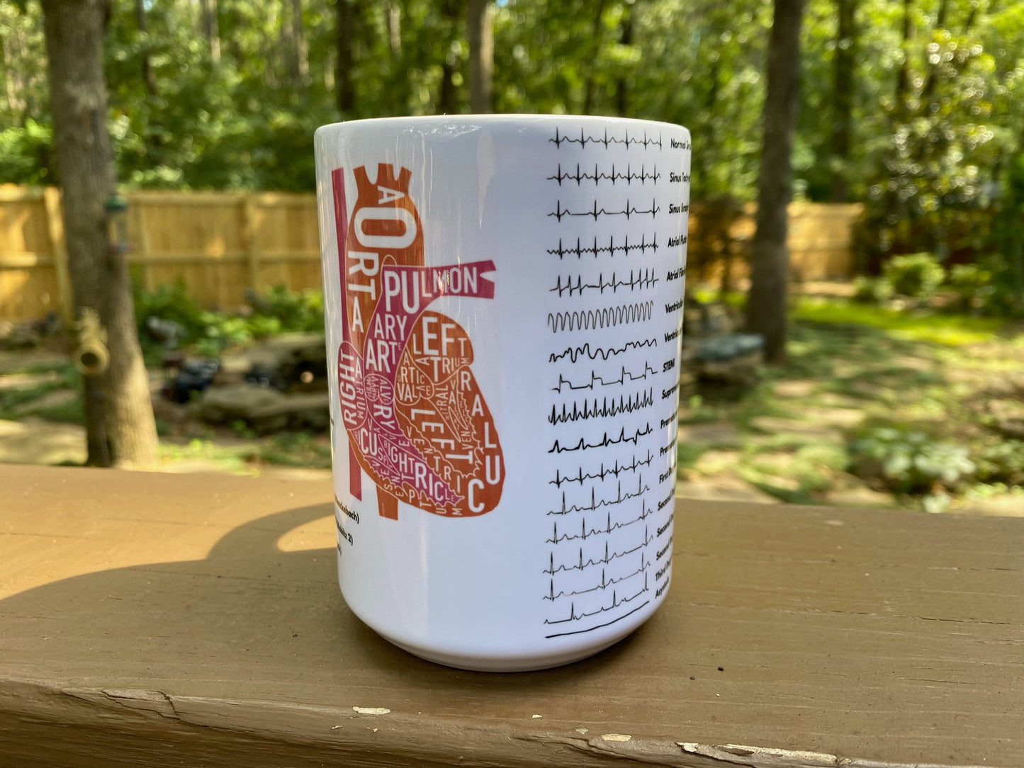 Cardiology Cardiac EKG ACLS | 15oz Ceramic Mug | Fun Gift for Nurses, Cardiologists, Medical Students, Electrophysiologists