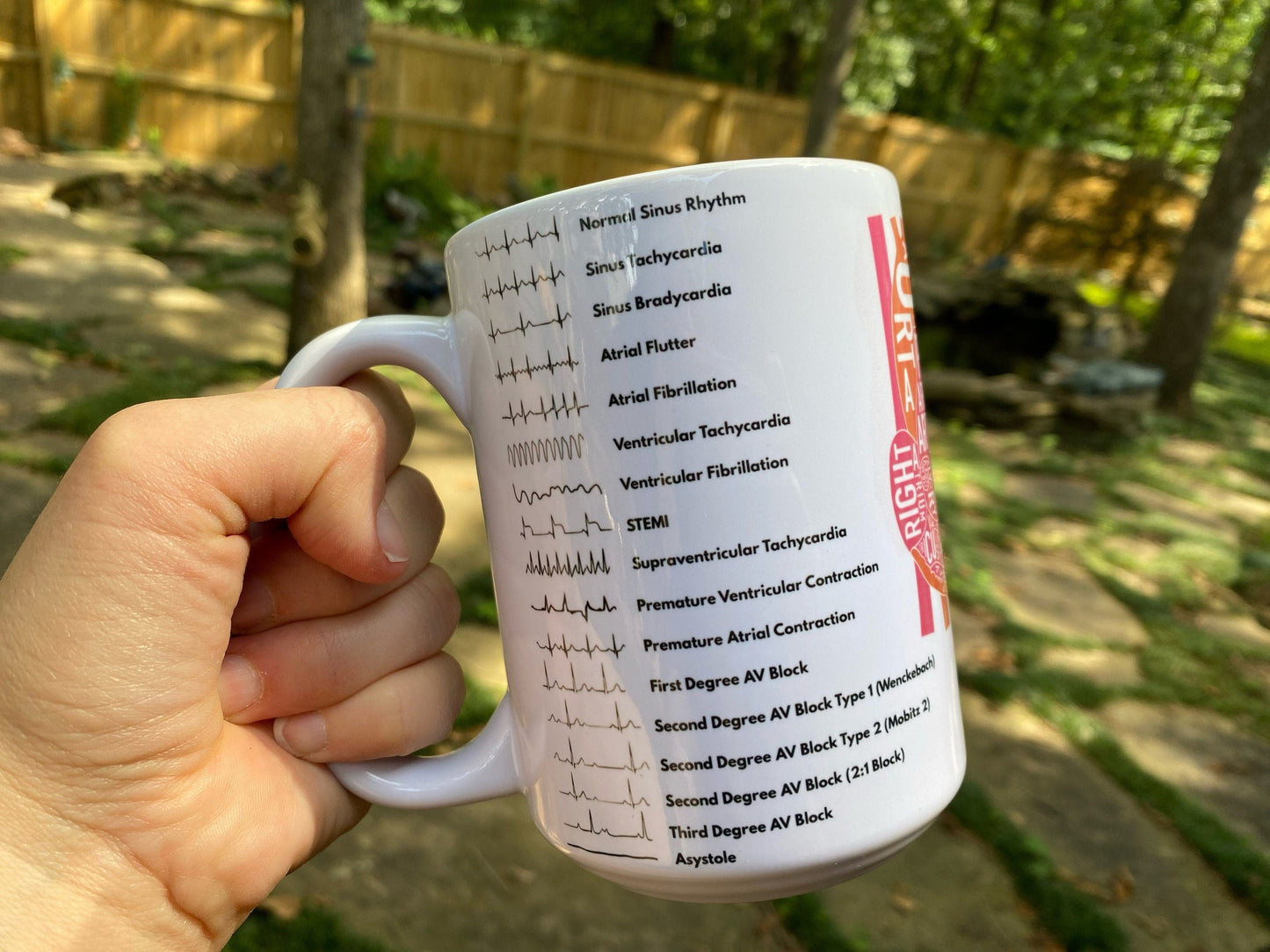 Cardiology Cardiac EKG ACLS | 15oz Ceramic Mug | Fun Gift for Nurses, Cardiologists, Medical Students, Electrophysiologists