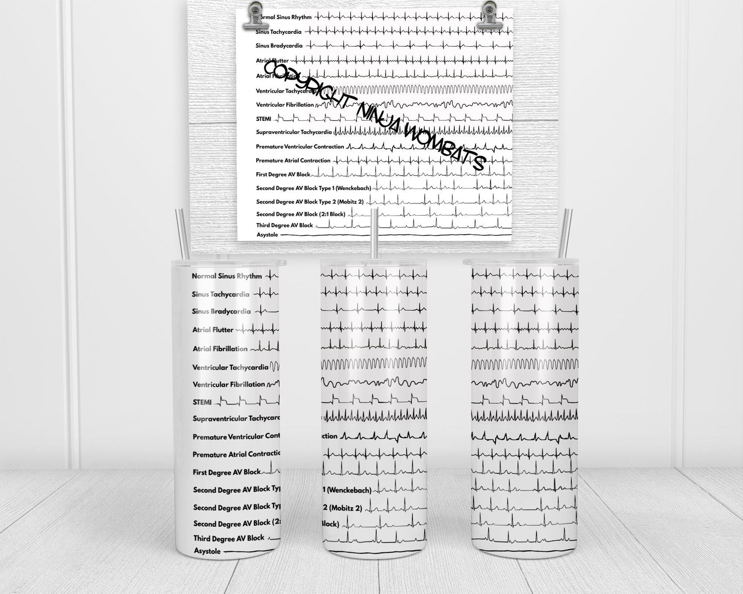 Personalized Cardiology Cardiac EKG ACLS | 30oz Skinny Tumbler | Fun Gift for Nurses, Cardiologists, Medical Students, Electrophysiologists