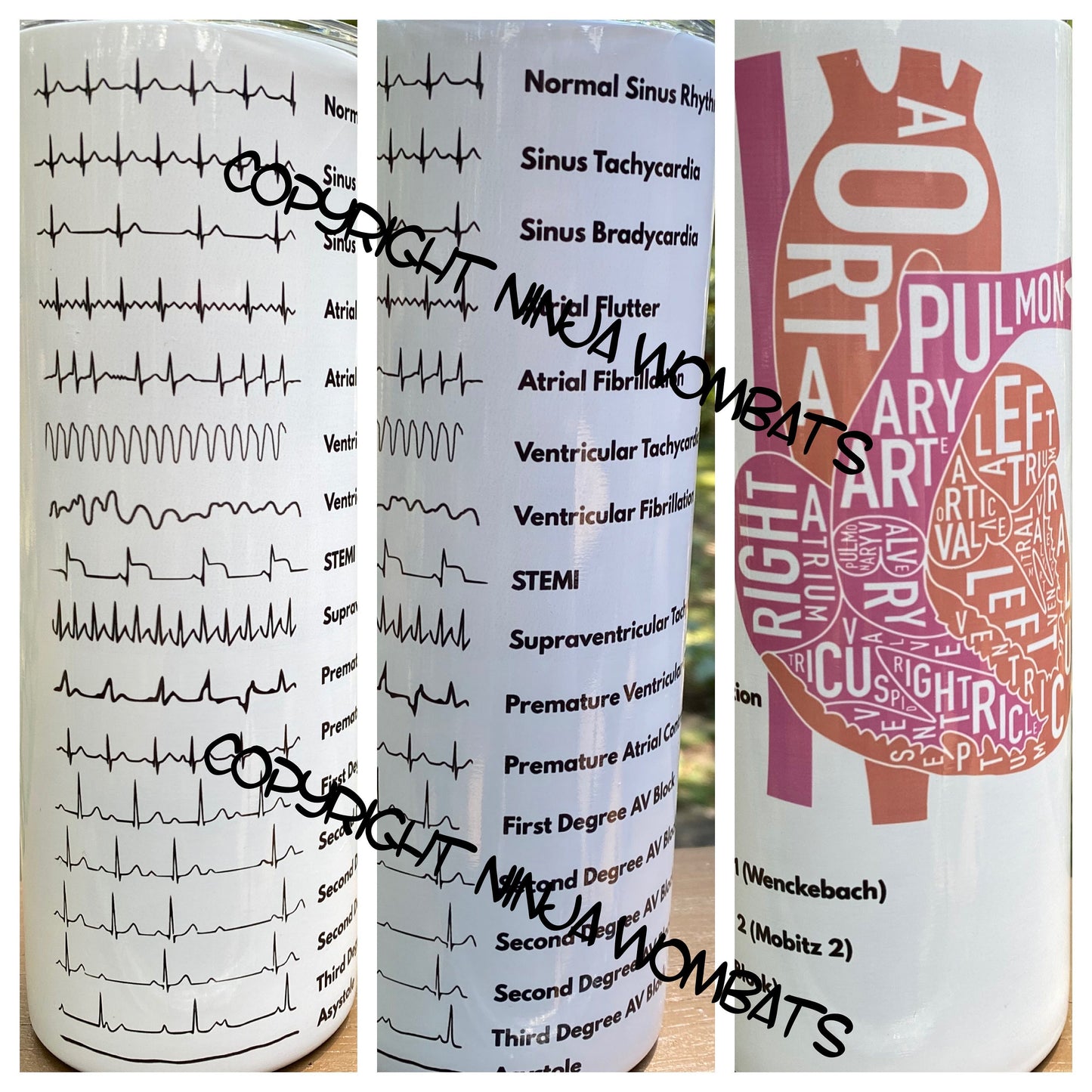 Cardiology Cardiac EKG ACLS | 30oz Skinny Tumbler | Fun Gift for Nurses, Cardiologists, Medical Students, Electrophysiologists